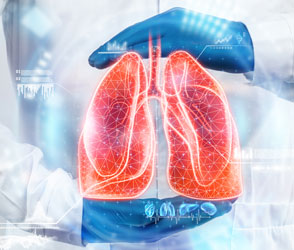 Lung Cancer